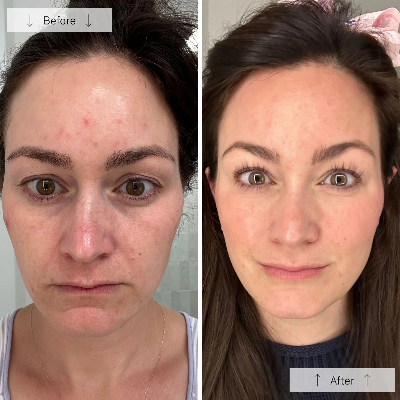 LED Anti-Ageing & Blemish Repair Mask