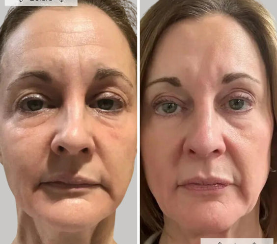 LED Anti-Ageing & Blemish Repair Mask