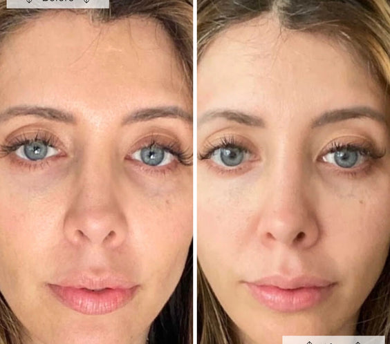 LED Anti-Ageing & Blemish Repair Mask