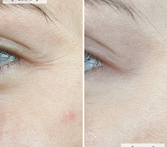 LED Anti-Ageing & Blemish Repair Mask