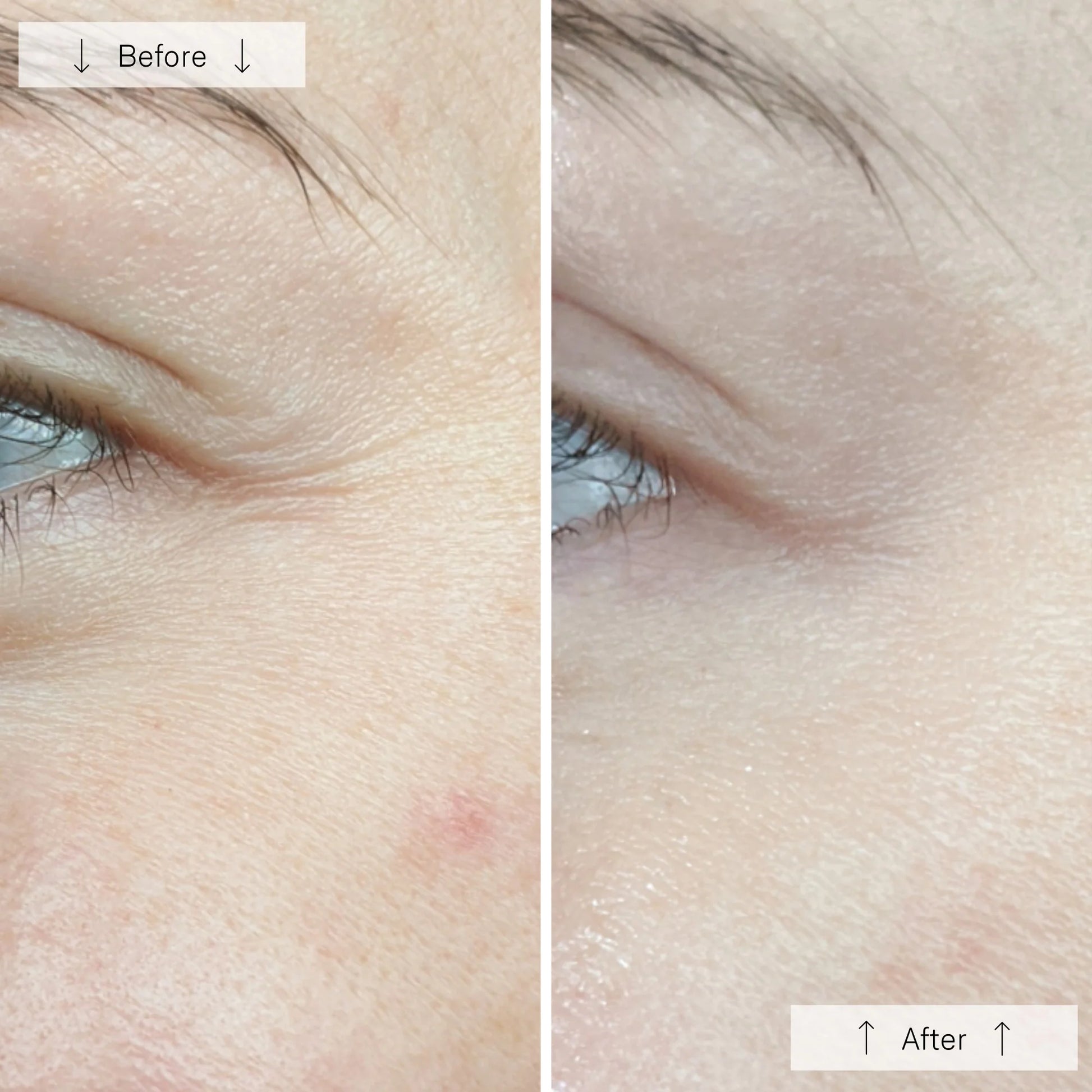 LED Anti-Ageing & Blemish Repair Mask